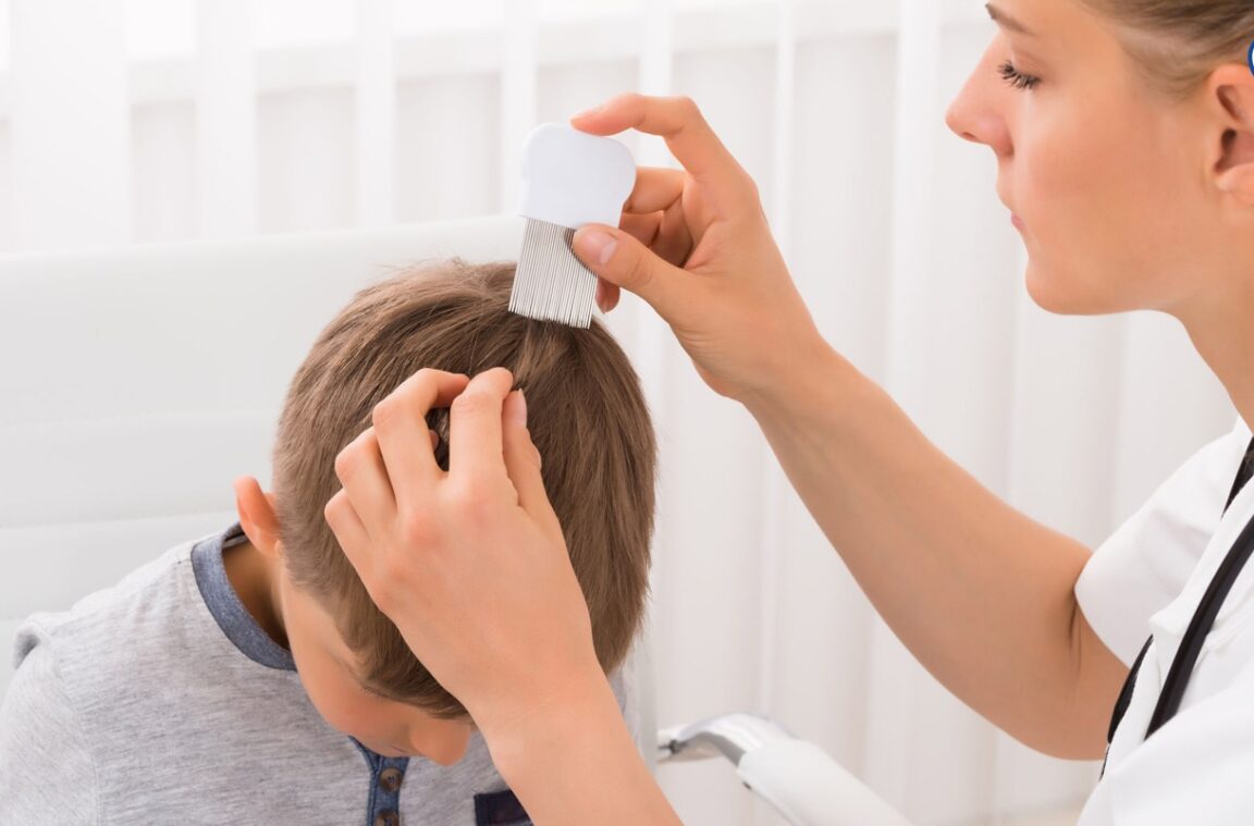 How To Get Rid Of Head Lice Explorer Life Easy Ways to Relax After